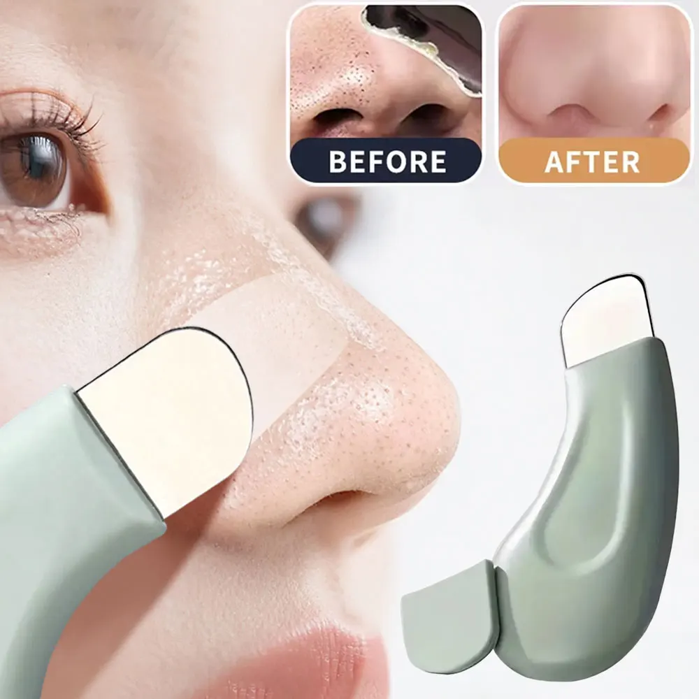 Nasal Aspirator - 얼굴의 블랙헤드 제거 도구, 깊숙이 세정하는