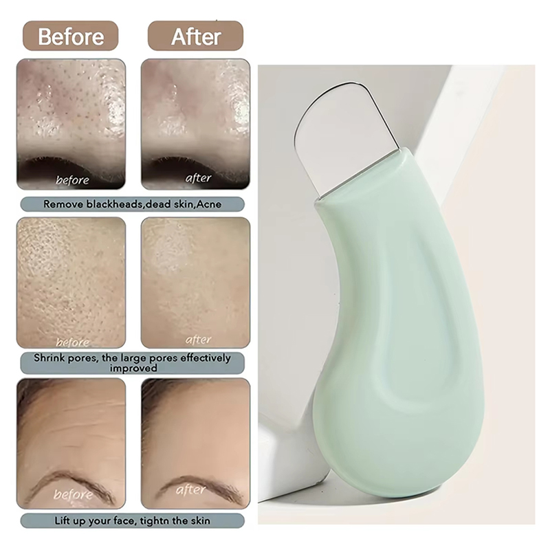 딥 클렌징 페이셜 블랙헤드 화이트헤드 제거 도구 코 화 - Nasal Aspirator 리뷰 및 가격