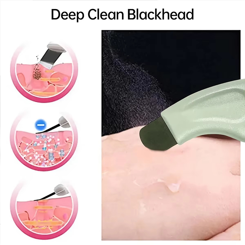 딥 클렌징 페이셜 블랙헤드 화이트헤드 제거 도구 코 화 - Nasal Aspirator 리뷰 및 가격